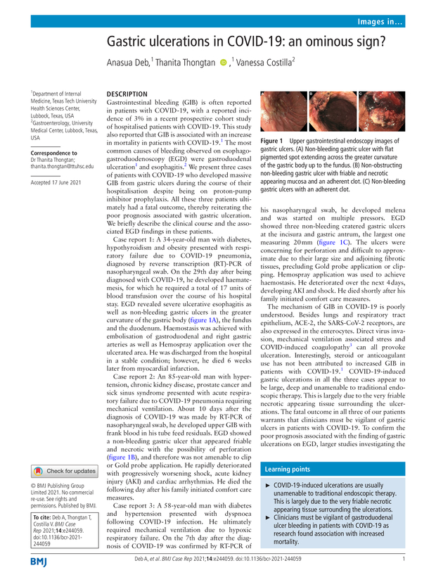 Omnious Text Extract Gastric ulcerations in COVID-19: an ominous sign? | BMJ Case Reports