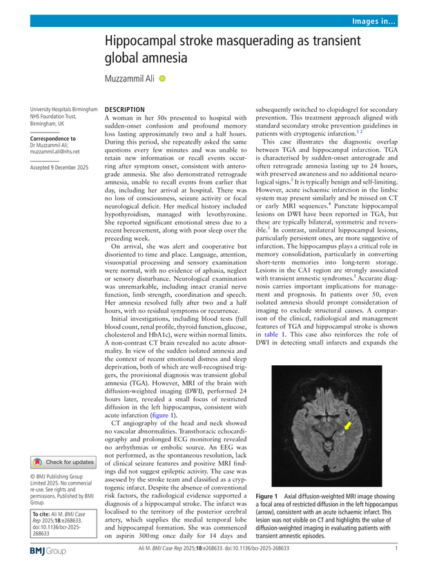 Hippocampal stroke masquerading as transient global amnesia | BMJ Case ...